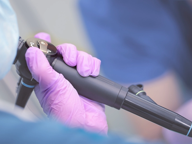 Endoscopy example for the use of epoxy resin molding compounds